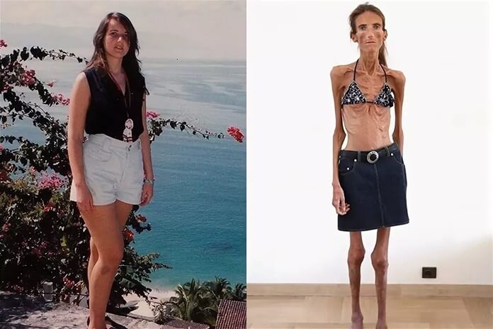 Валерия Левитина, фото до и после похудения