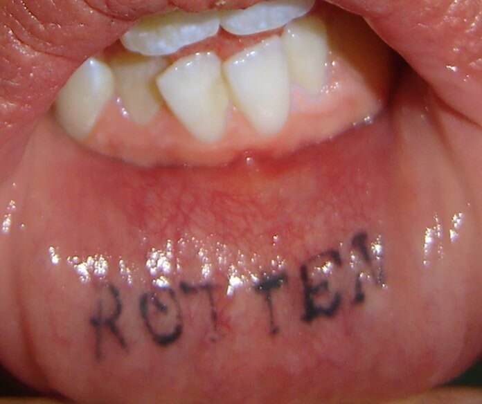 Rotten | Worst Lip Tattoos