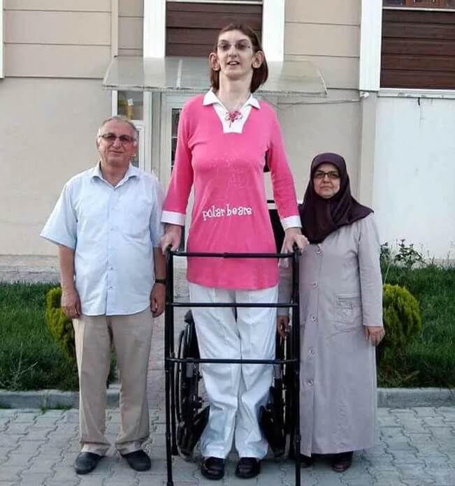Румейса Гелги – самая высокая женщина в мире, её рост 215,16 см.